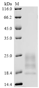 SDS-PAGE