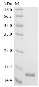 SDS-PAGE
