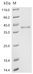 SDS-PAGE