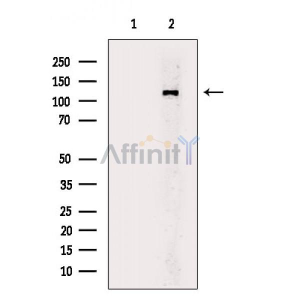 Валидация Affinity DF6201 - 17460