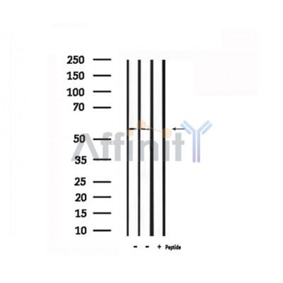 Валидация Affinity DF6372 - 17726