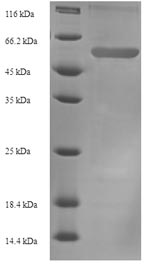 SDS-PAGE