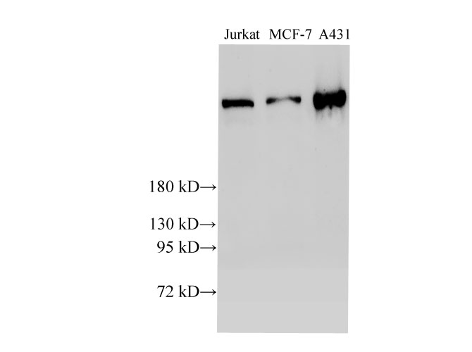 Вестерн-блоттинг, BRCA2, клетки Jurkat, MCF-7 и A431