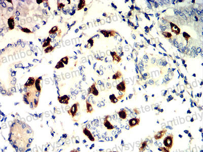 Валидация AntibodySystem RHF04402