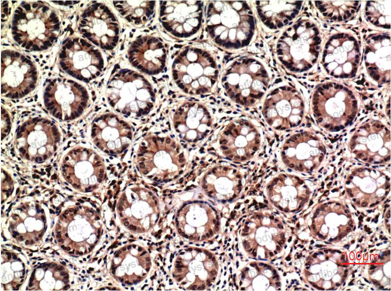 Валидация AntibodySystem RHD73615