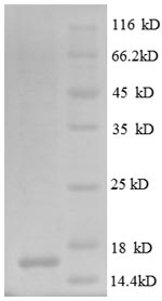 SDS-PAGE
