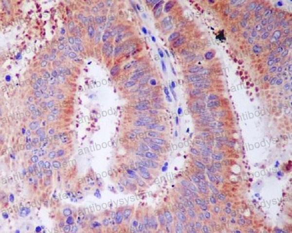 Валидация AntibodySystem RHD57201