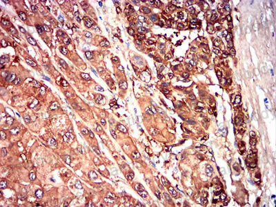 Валидация AntibodySystem RHC65501