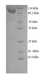 SDS-PAGE