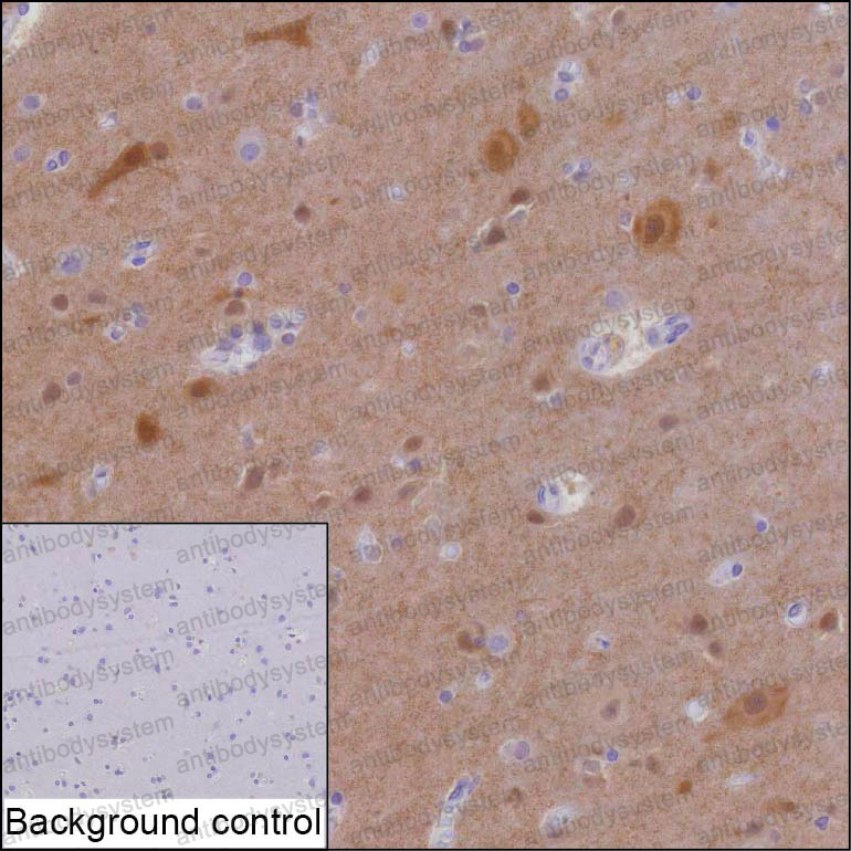 Валидация AntibodySystem RHJ17506