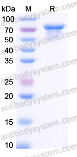 EHJ28404, SDS-PAGE