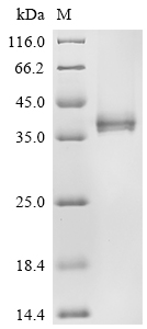 SDS-PAGE