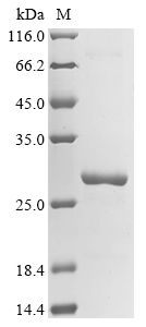 SDS-PAGE