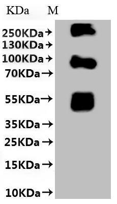 SDS-PAGE