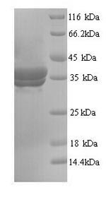 SDS-PAGE