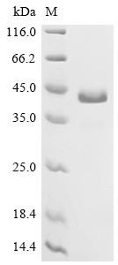 SDS-PAGE