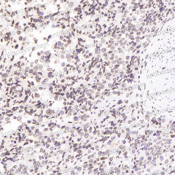 Валидация AntibodySystem RHD40901 (1569)