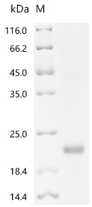SDS-PAGE