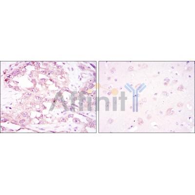 Валидация Affinity BF9215 - 5432