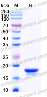 YHK05402, SDS-PAGE