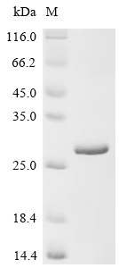 SDS-PAGE