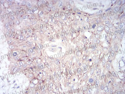 Валидация AntibodySystem RHC30602