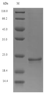 SDS-PAGE