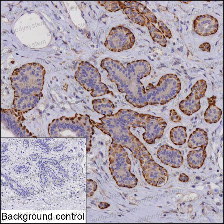 Валидация AntibodySystem RHE45103