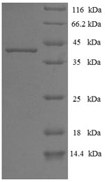 SDS-PAGE