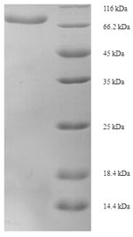 SDS-PAGE
