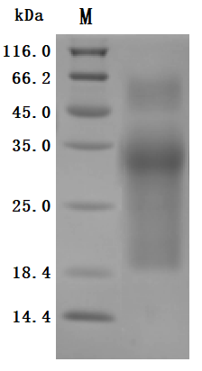 SDS-PAGE
