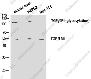 Вестерн-блоттинг, TGF β Receptor II, различные клетки
