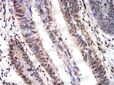 Валидация AntibodySystem RHG69002