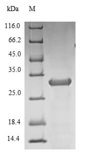 SDS-PAGE