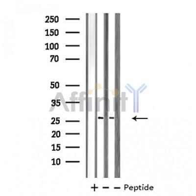 Валидация Affinity DF4274 - 15677