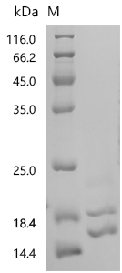 SDS-PAGE
