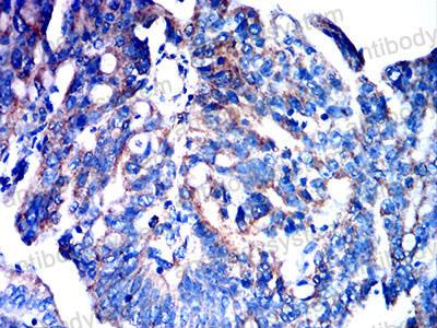 Валидация AntibodySystem RHD65402