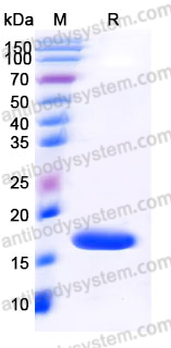 AHJ72801, SDS-PAGE