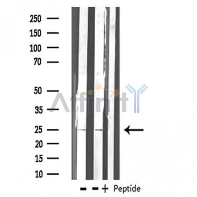 Валидация Affinity AF4200 - 2171