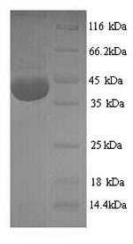 SDS-PAGE