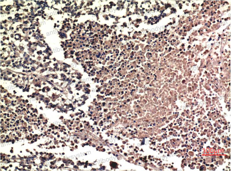 Валидация AntibodySystem RHD73615 (1779)