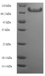 SDS-PAGE