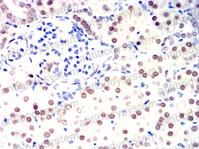 Валидация AntibodySystem RHE14902 (2002)