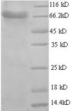 SDS-PAGE