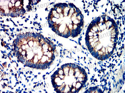 Валидация AntibodySystem RHD65401 (1692)