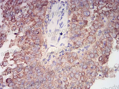 Валидация AntibodySystem RHD96512