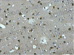 Валидация AntibodySystem RHC85501