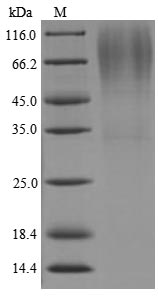 SDS-PAGE