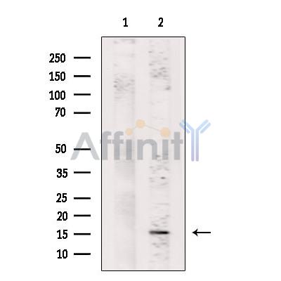 Валидация Affinity DF6749 - 18298