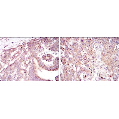 Валидация Affinity BF0593 - 5317